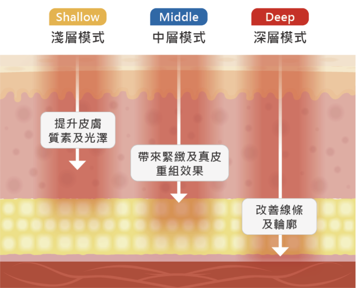 三個不同治療深度